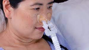 the new cpap mask without headgear