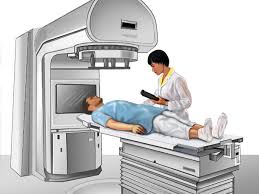 external beam radiation therapy for