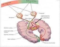 How Stroke Affects Vision