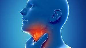 sore throat be caused by silent reflux