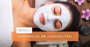 which-is-better-chemical-peel-or-hydrafacial