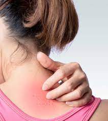 hiv skin rashes symptoms causes and