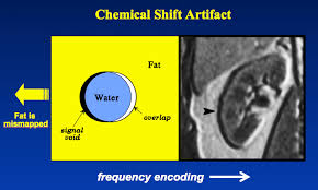 chemical shift artifact questions and