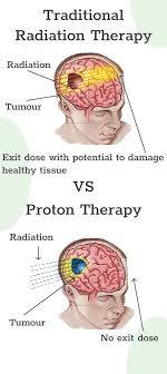 proton therapy cost in india better