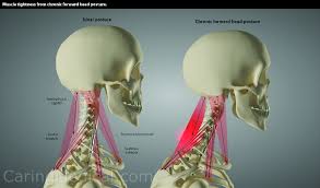 us nerve compression in the neck