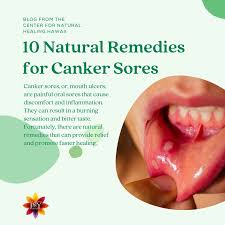 homeopathic remedy for canker sores 10