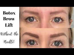 botox brow lift using makeup