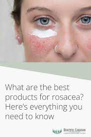 what are the best s for rosacea