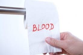 Mögliche ursachen für blut im stuhl sind: Blut Im Stuhl Mogliche Ursachen Besser Gesund Leben