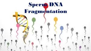 Sperm DNA Fragmentation - IVF Center in Jaipur by Vasundhara Hospital &  Fertility Research Centre Jaipur - issuu