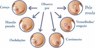 Resultado de imagem para SAÚDE E EQUILÍBRIO - As 10 principais causas de câncer de mama