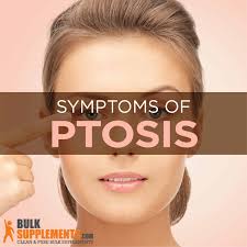 ptosis symptoms causes treatment