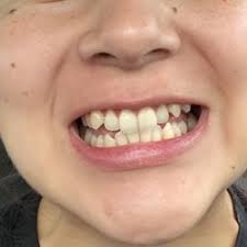 We provide care to families in chino valley, diamond bar, eastvale and corona. Samuel S Berro Dds 41 Reviews Orthodontists 3662 Katella Ave Los Alamitos Ca United States Phone Number