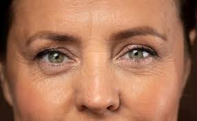 exercises for drooping eyelids tips