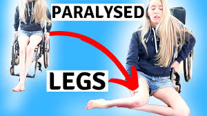 my paralysed legs