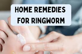 home remes for ringworm how to