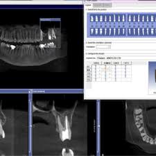 dental cone beam computedtomography