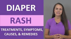 diaper rash treatment causes symptoms