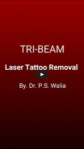laser tattoo removal i tri beam laser