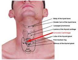 cricopharyngeus spasm and what to do