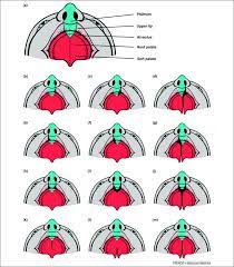 genetics of oro clefting