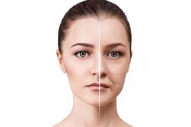 get rid of under eye wrinkles