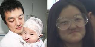 Faye is angry and told us that she will take everything to. Faye Wong S 12 Year Old Daughter Gets Second Cleft Lip Surgery Jaynestars Com