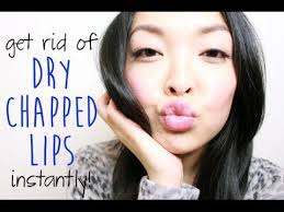 get rid of dry chapped lips instantly