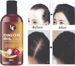 It reduces dandruff and dryness from hair and cleanses the scalp. Indo Challenge Onion Black Seed Oil For Hair Regrowth Hair Fall Control 14 Essential Oils