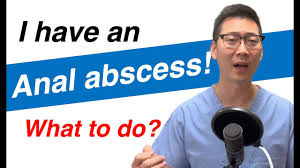 abscess now what what you need