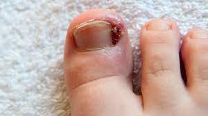 foot health common issues and how to
