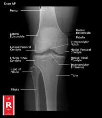 They move when you do—when you walk, run, dance, stretch your legs, or make any action you can think of that there are two muscle groups that act on the knee joint: Normal Knee Xray Knee Joint Anatomy Knee Replacement Surgery
