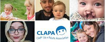 cleft care uk policybristol