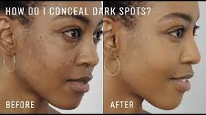 how to cover dark spots and even out