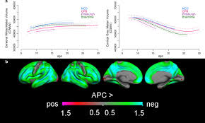 Media Use And Brain Development During Adolescence Nature