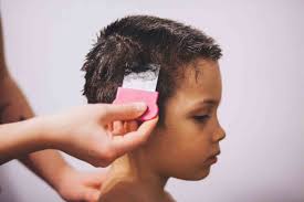 hair loss in children should you be