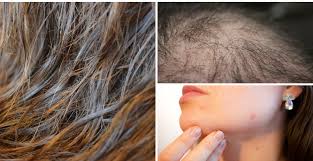 Most commonly, hair loss is hereditary and progresses as we age. 9 Reasons Why You Should Never Sleep With Wet Hair Expert Home Tips