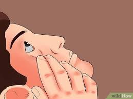 how to use erythromycin eye ointment