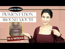 how to treat pigmentation around mouth