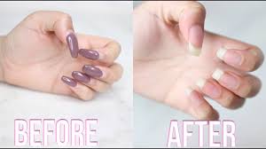 how to remove acrylic nails safely