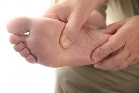 foot fungus requires cal treatment