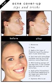 how to acne and blemish cover up