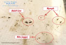 how to identify head lice and nits