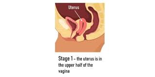 uterus treatment propel