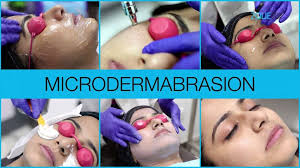 microdermabrasion treatment for smooth
