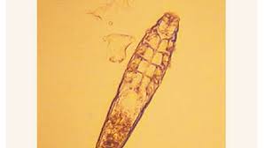 what are demodex mites these 8 legged