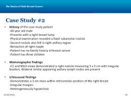 NUR     Quiz   Case Studies   NUR     Quiz   Case Studies Case     Breast cancer  Intraductal carcinoma  comedo type 