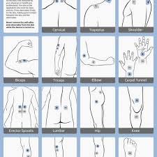 Awesome Tens Unit Placement Chart Facebook Lay Chart
