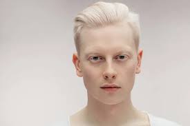 albino images