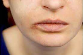 pigmented lips causes treatment more